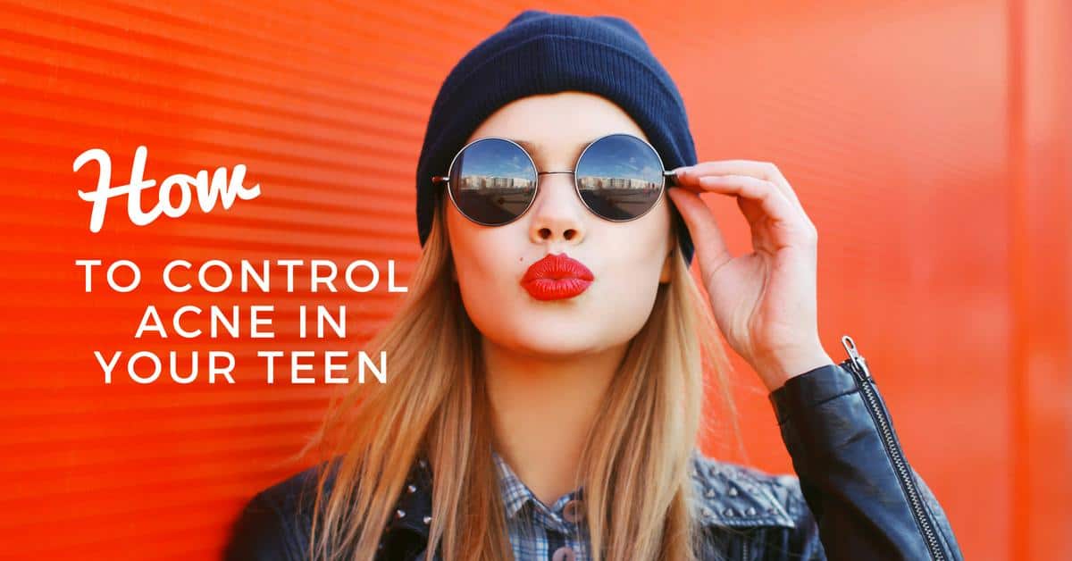 How to Control Acne in Your Teen