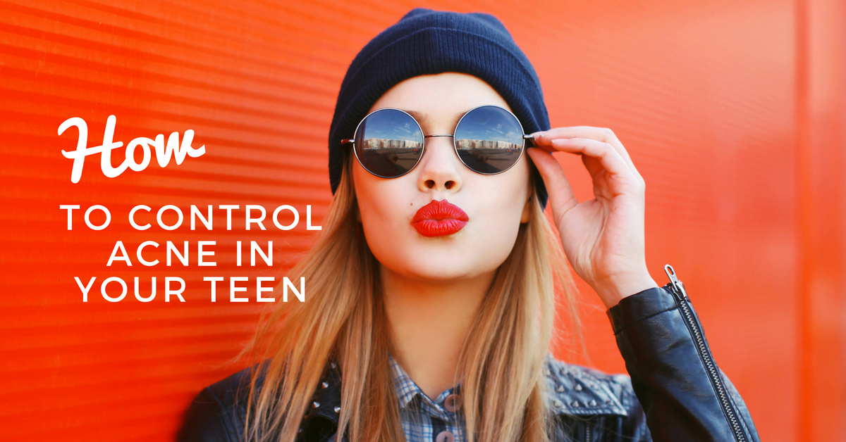 How to Control Acne in Your Teen How to Control Acne in Your Teen